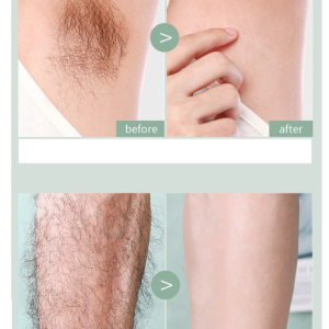 Cây Cạo Lông Share Đầu Tròn