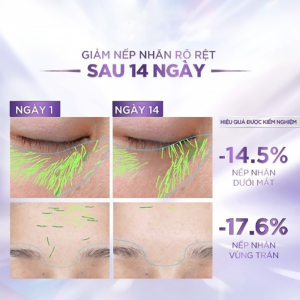 Kem Dưỡng L'oreal Paris 50ml Revitalift Hyaluronic Acid Line Filling Water