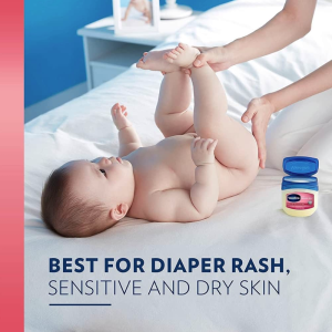 Dưỡng Đa Năng Vaseline 368g Baby Healing Jelly