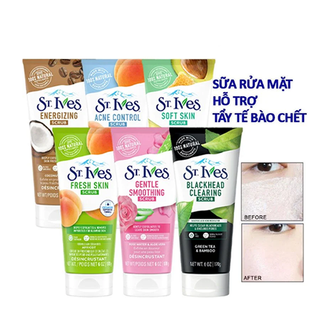 Sữa Rửa Mặt Tẩy Tế Bào Chết St.Ives