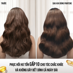 Dầu Xả Panten 300ml Phục Hồi Hư Tổn, Ngăn Ngừa Gãy Rụng