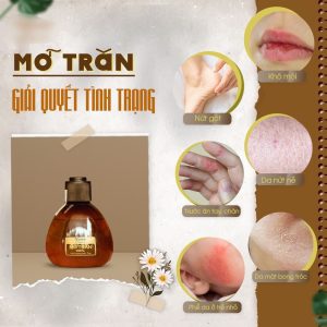 Mỡ Trăn N-store 75g