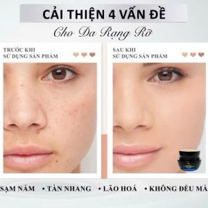 Kem sâm đen Dakami Black Ginseng - Làm mờ nếp nhăn, ngăn ngừa lão hóa, giúp da trắng sáng