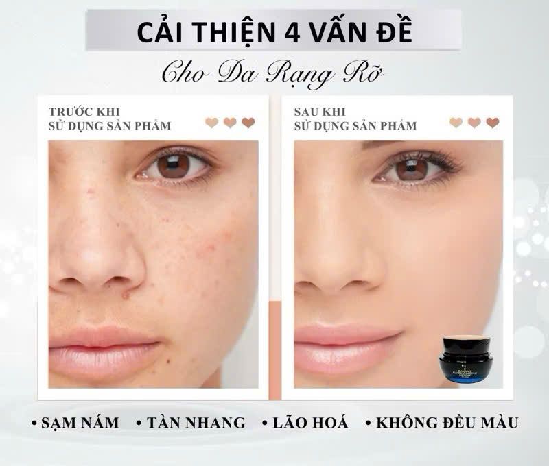 Kem sâm đen Dakami Black Ginseng - Làm mờ nếp nhăn, ngăn ngừa lão hóa, giúp da trắng sáng