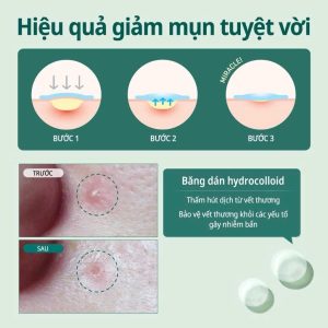 Miếng Dán Trị Mụn Some By Mi Clear Spot Patch 18pcs